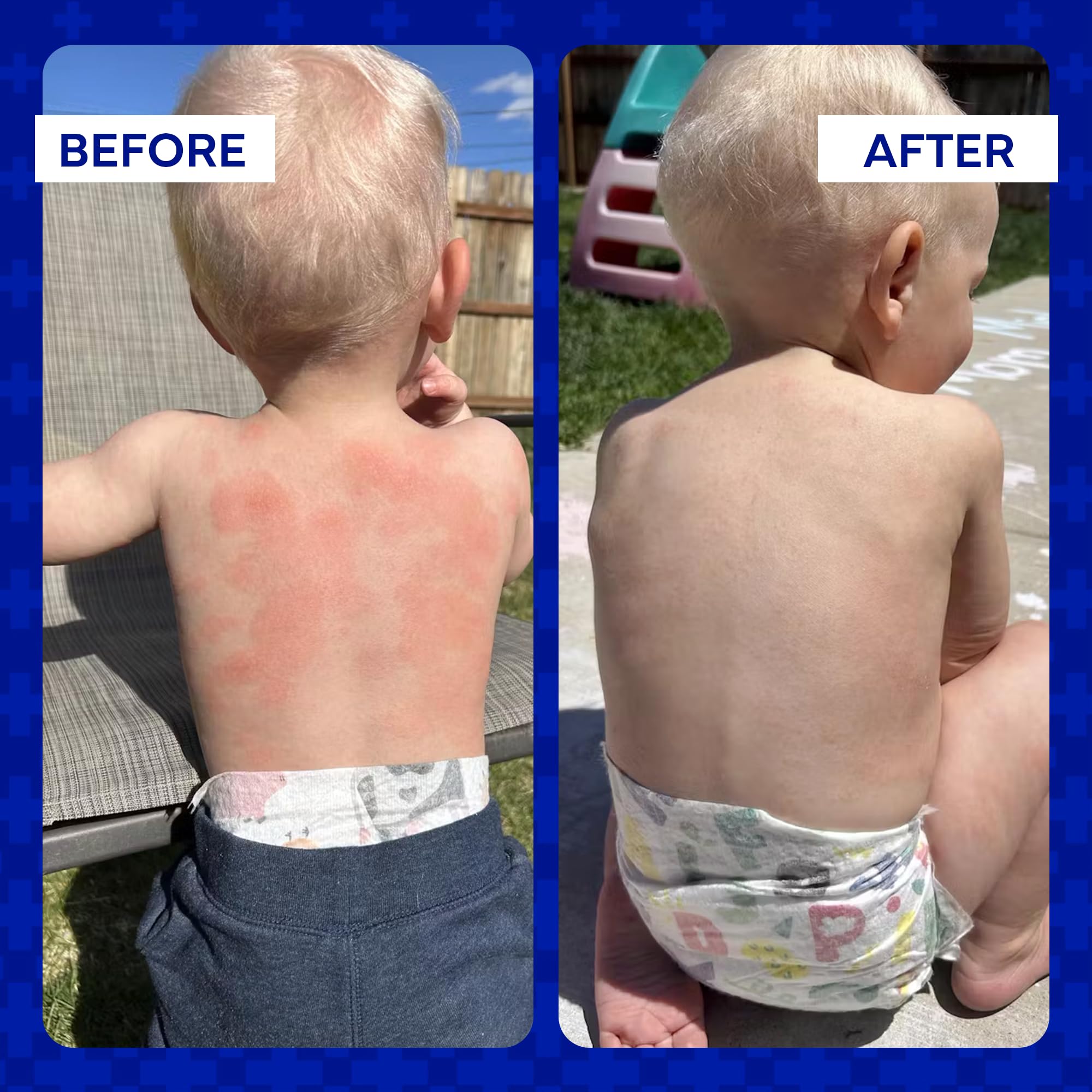 Family-friendly Emuaid Ointment suitable for all ages including infants.