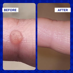 Emuaid Ointment bottle showcases fragrance-free, chemical-free formula.