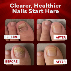 EMUAIDMAX clinically-inspired fungal care depiction emphasizes targeted nail health.