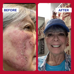 emuaidMAX ingredients vitamin-e focus on skin nourishment and restoration