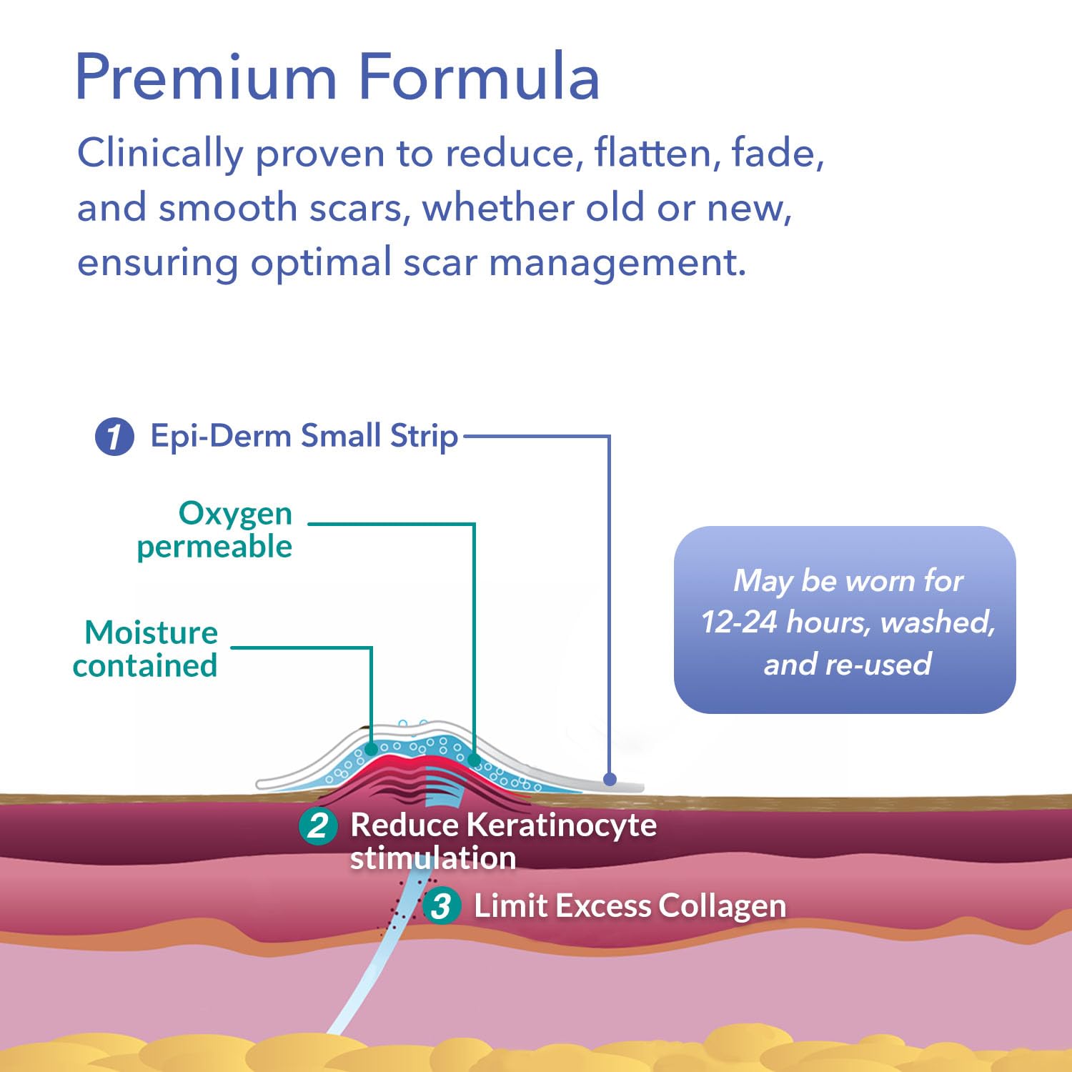 EpiDerm customizable flexible fit demonstrates trim-to-size capability.