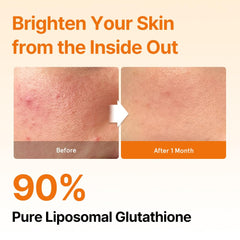 ESTHER FORMULA liposomal glutathione strips lemon flavor offering zesty citrus aroma.