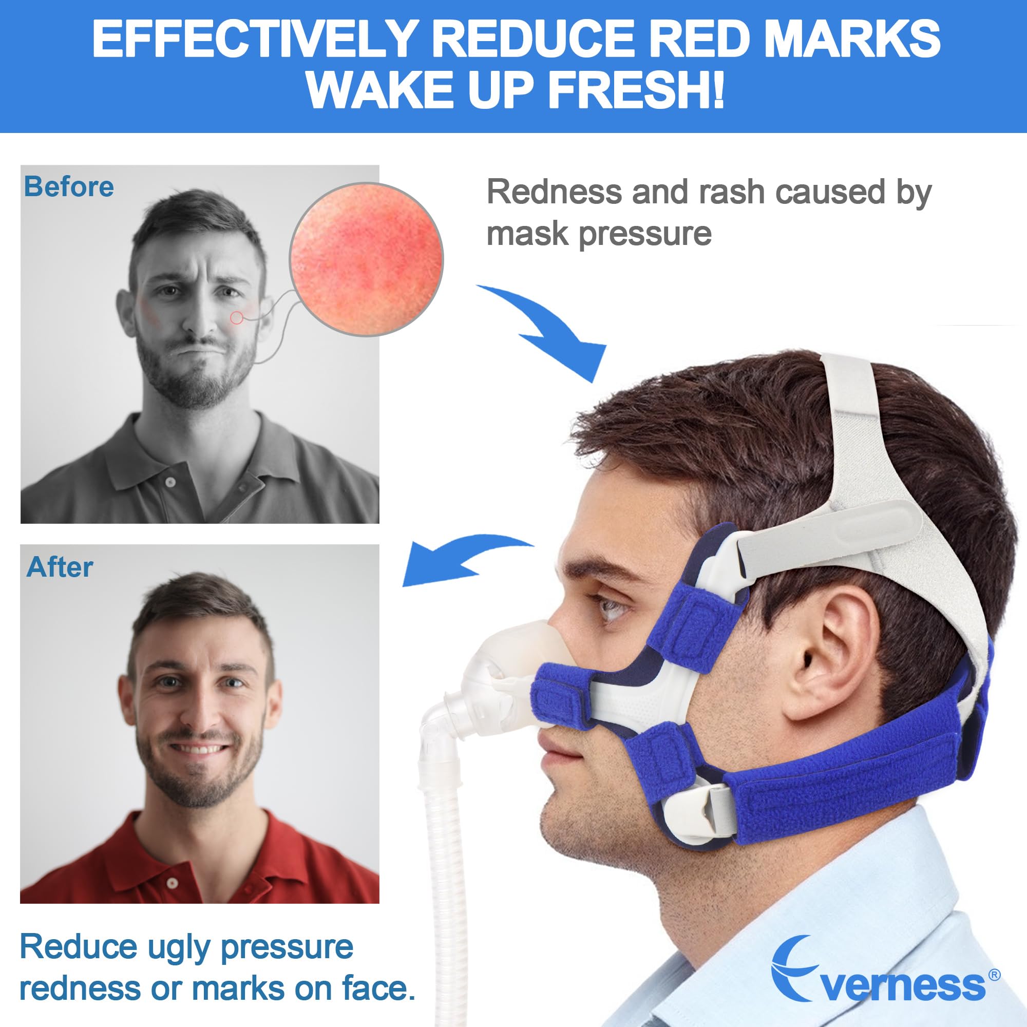 Everness N20 replacement kit image conveys cushion not included