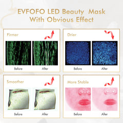 EVFOFO red light mask contoured design for daily comfortable use
