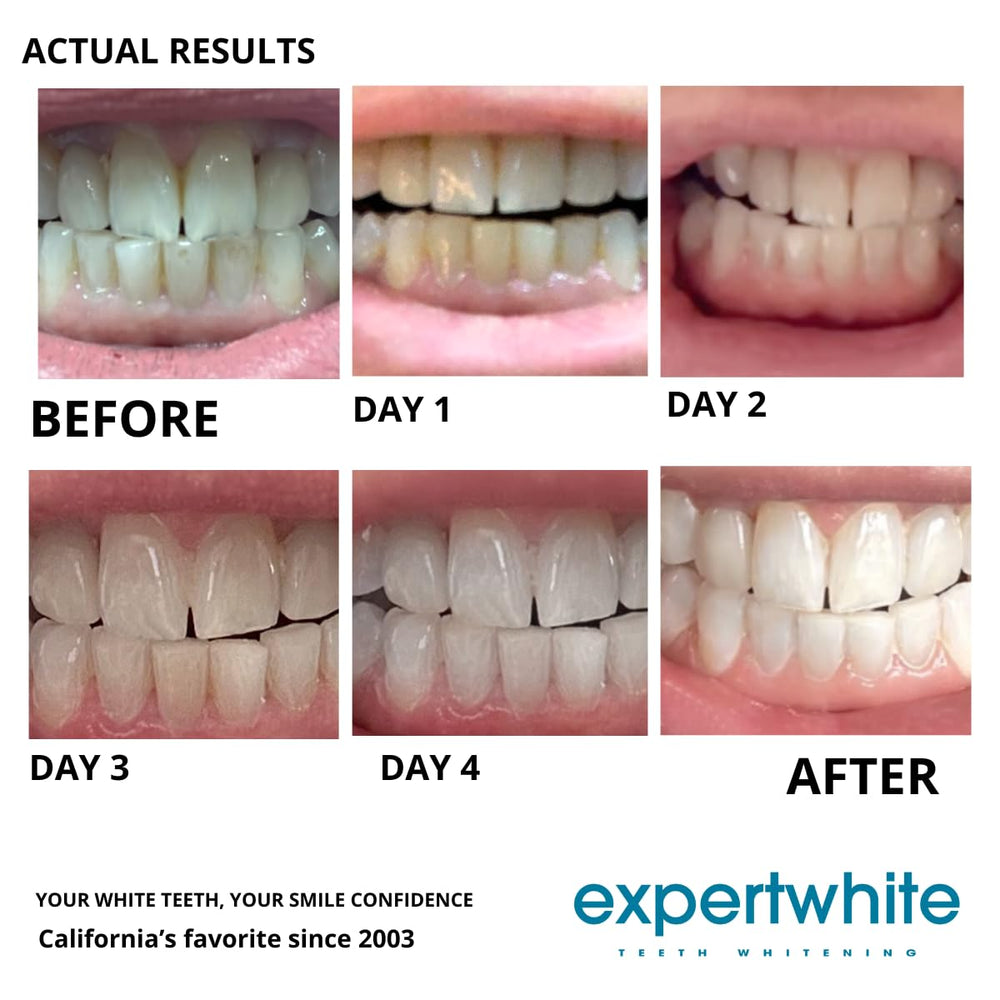 Made in USA enamel-friendly formula supports safe whitening.