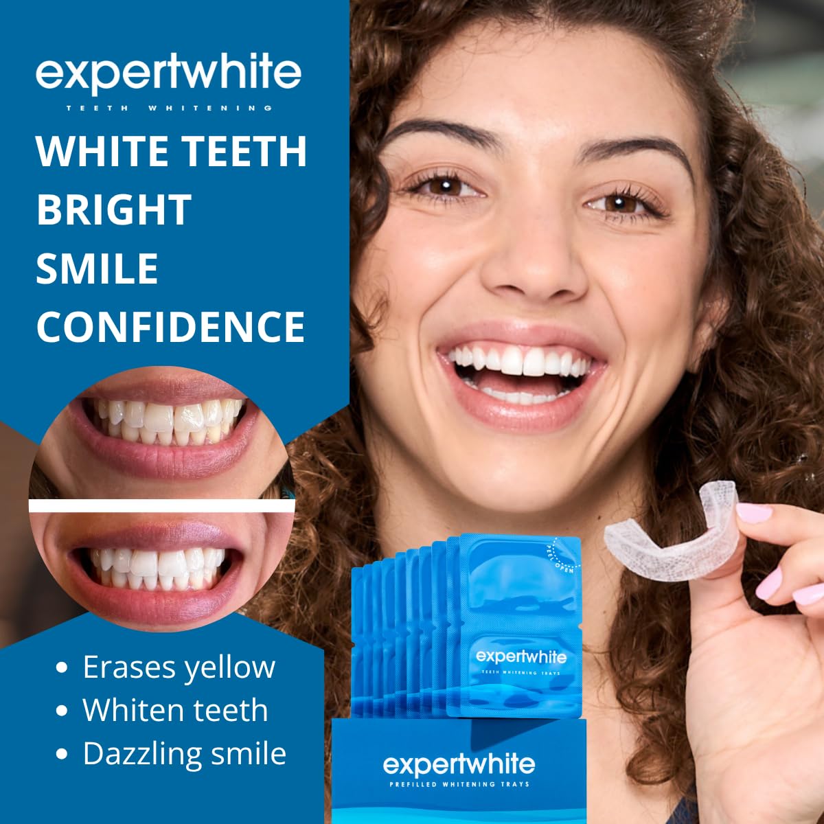 ExpertWhite Max Glow Trays top-teeth application showing precise fit.