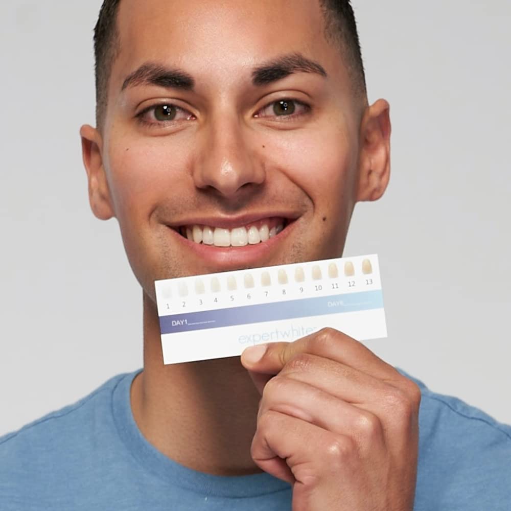 Common stains from coffee, tea, and wine respond to Expertwhite gel.