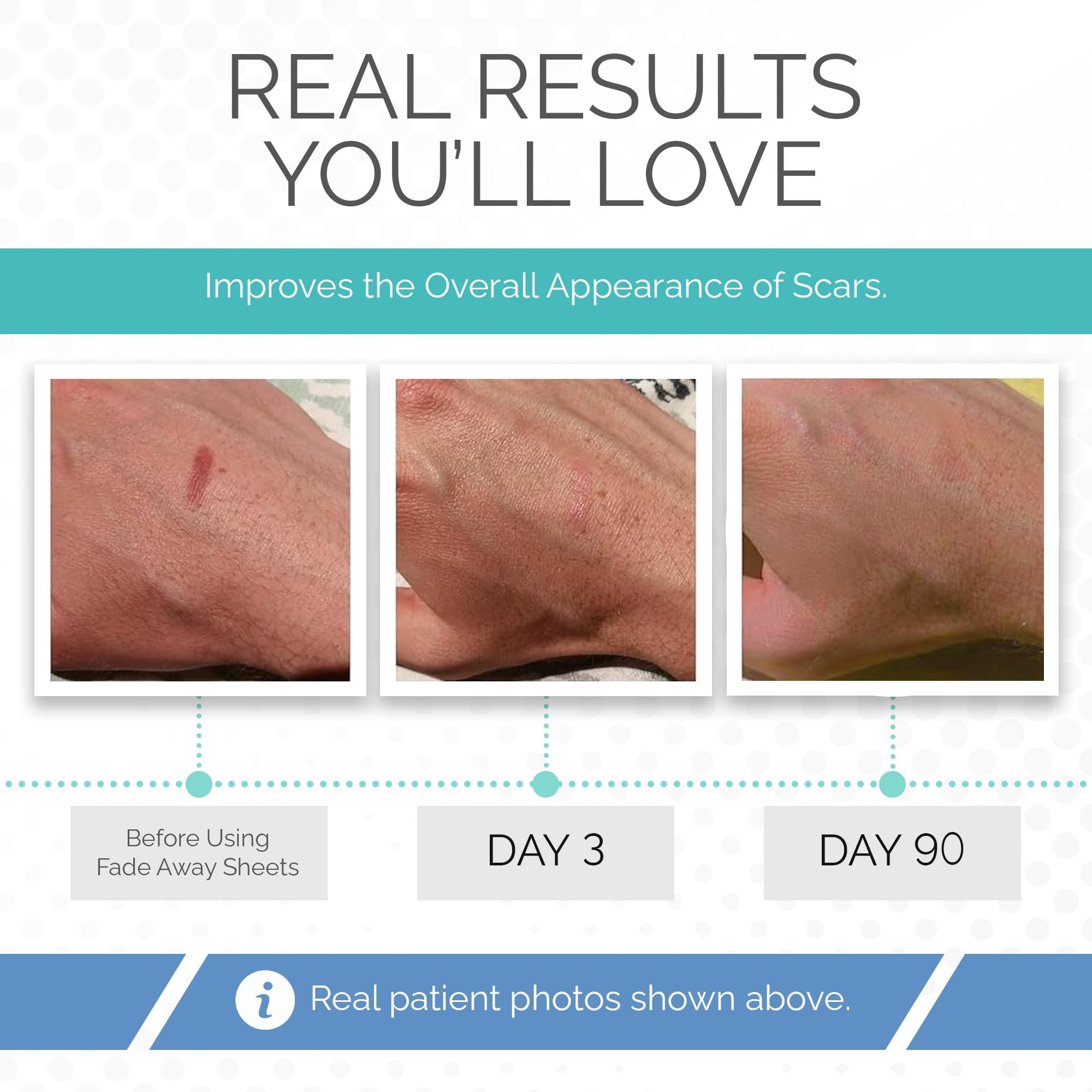 Fade Away silicone scar sheets suit diverse skin types with hypoallergenic safety.