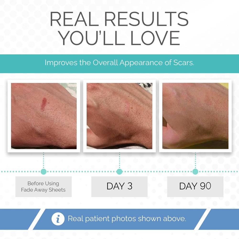 Fade Away silicone scar sheets suit diverse skin types with hypoallergenic safety.