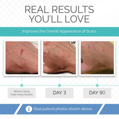 Fade Away silicone scar sheets suit diverse skin types with hypoallergenic safety.