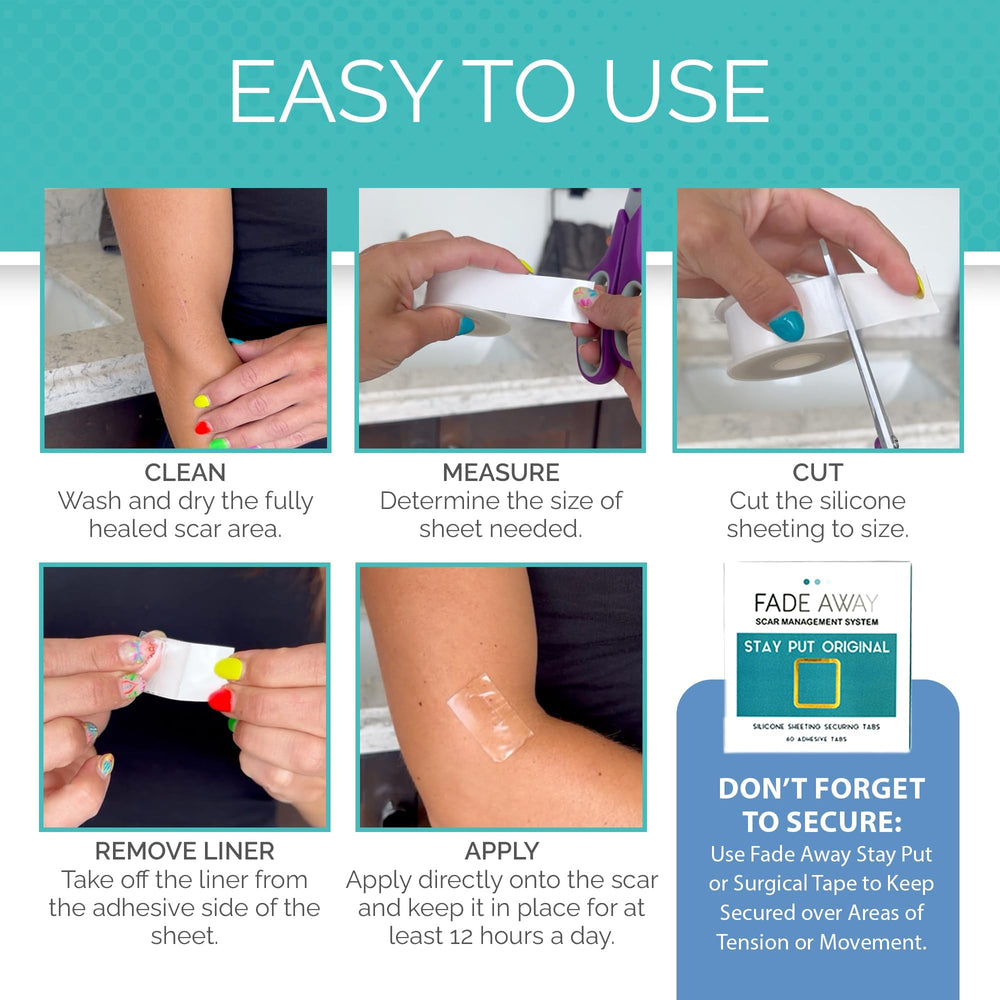Fade Away silicone scar sheets create a moist healing environment for scar management.