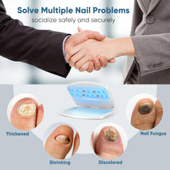 FEIGOMA Nail Fungus Light Device foot in use for toenail care