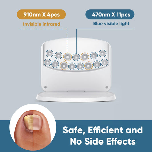 FEIGOMA Nail Fungus Light Device side view highlighting slim profile for discreet home use