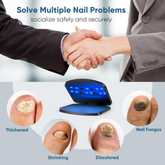 FEIGOMA Nail Fungus Light Device shows time settings for precise sessions.