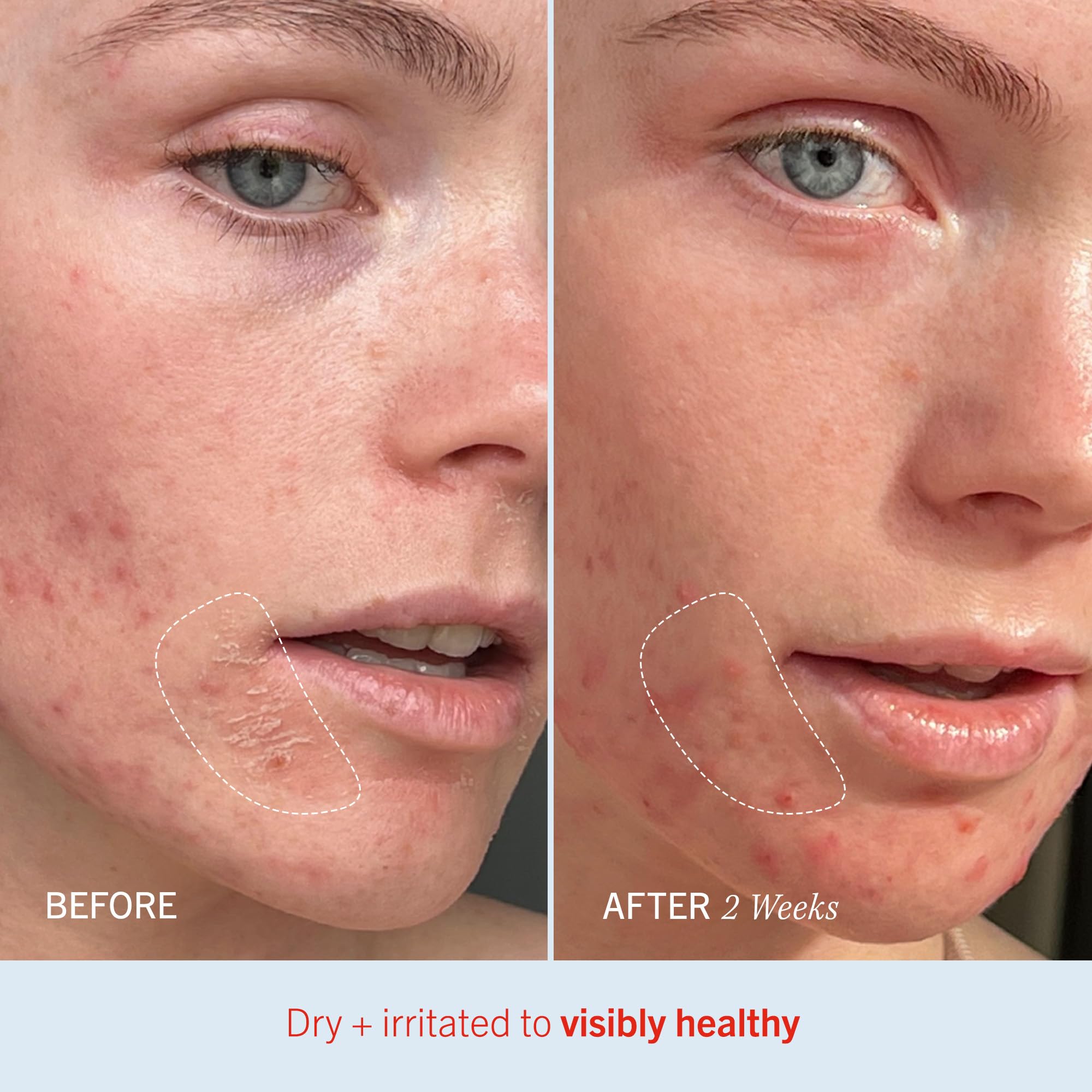 Body application of First Aid Beauty Ultra Repair Cream for full-body hydration