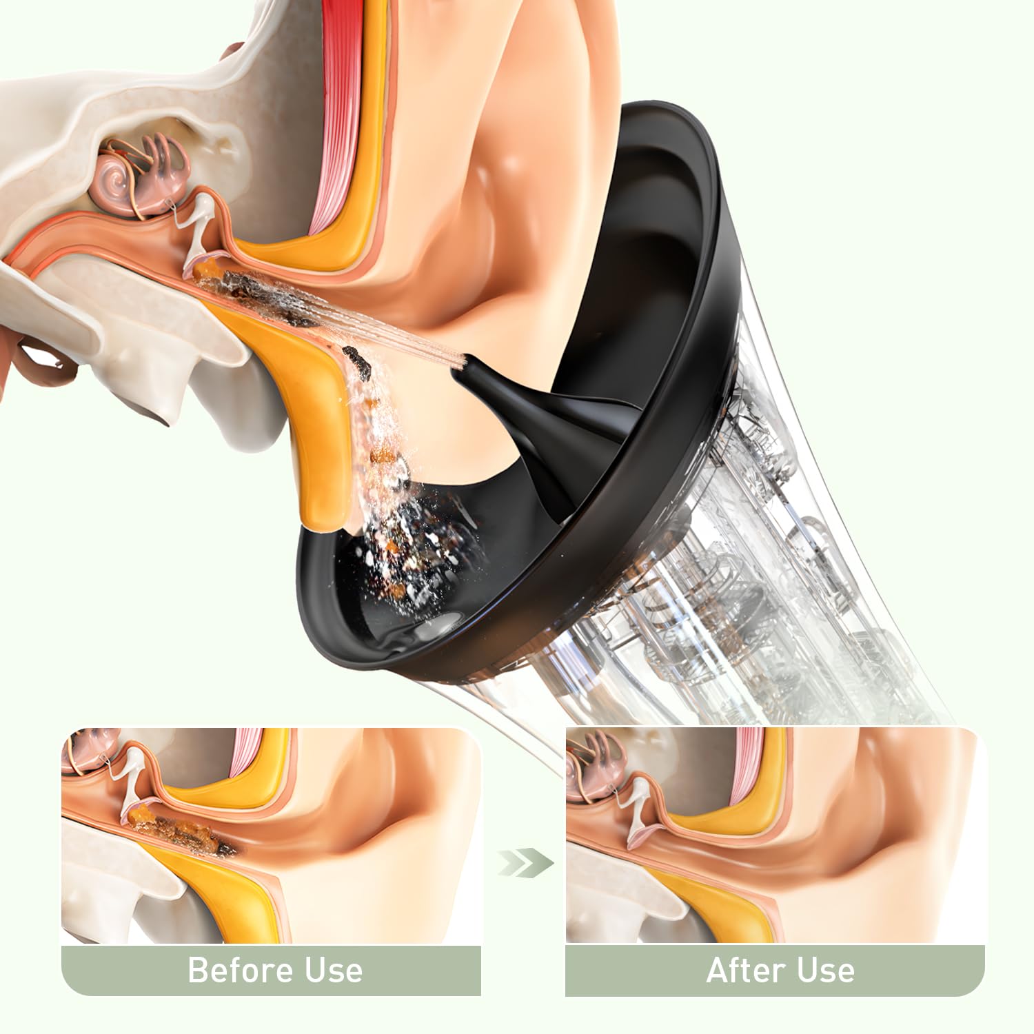 FlaoAito ear cleaner pressure dial with four modes for comfort.