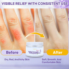 Florvyn hyaluronic glycerin panthenol moisture boost on dry skin