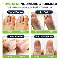FOOT CURE cracked heels soak for soothing foot care