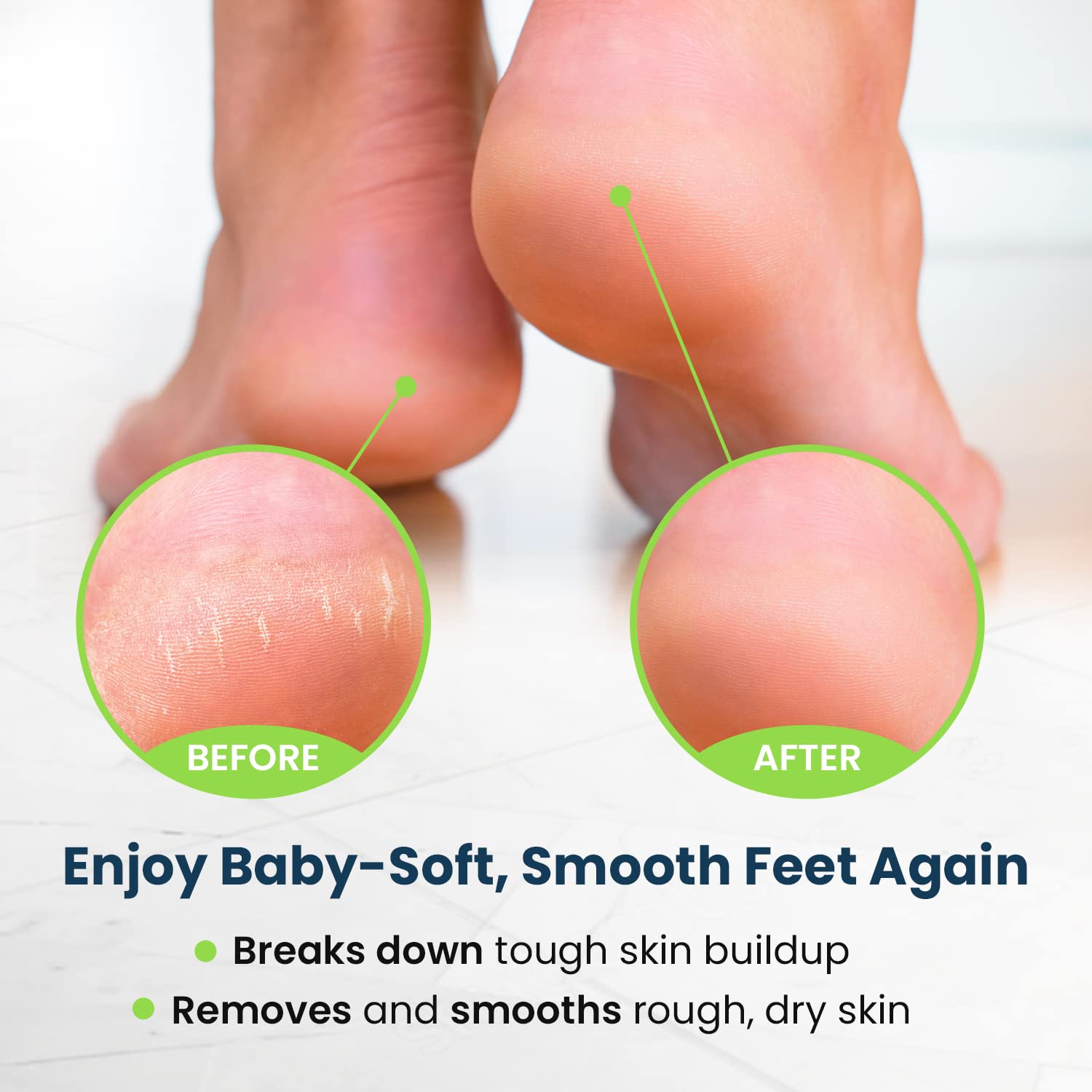 FOOT CURE electric foot bath massager basin included
