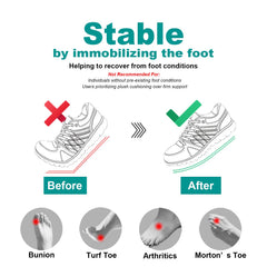 Freeior carbon fiber insole inside shoe demonstrates discreet, strong arch stabilization.