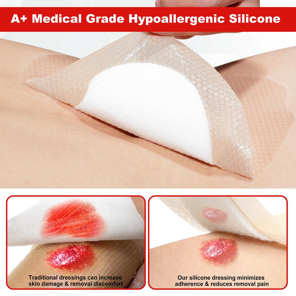 FRESINIDER 7x7 wound care dressing uses SAF layer to lock in fluids.