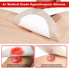FRESINIDER 7x7 wound care dressing uses SAF layer to lock in fluids.