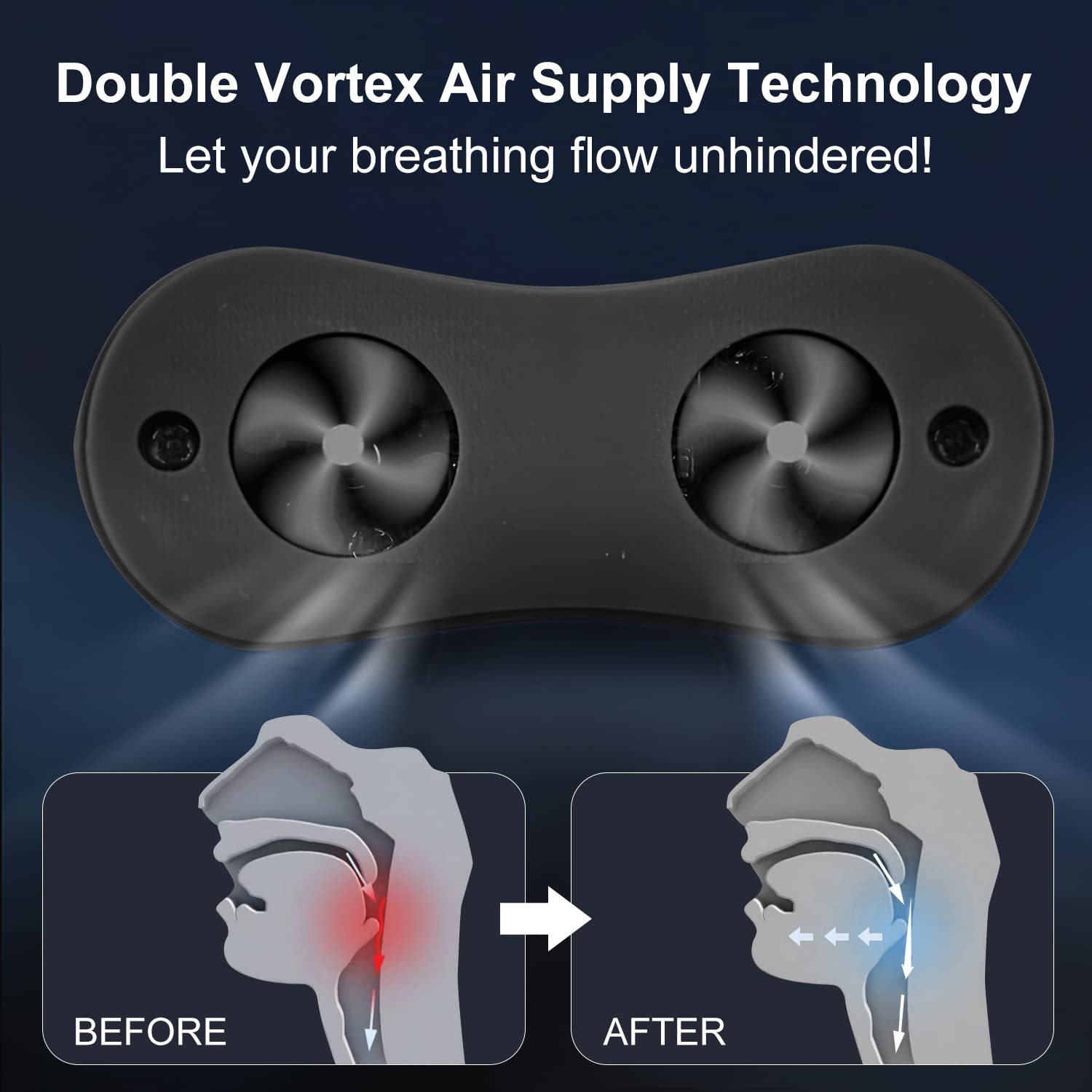 FXMFXM device delivers gentle micro-vibrations to reduce interruptions.