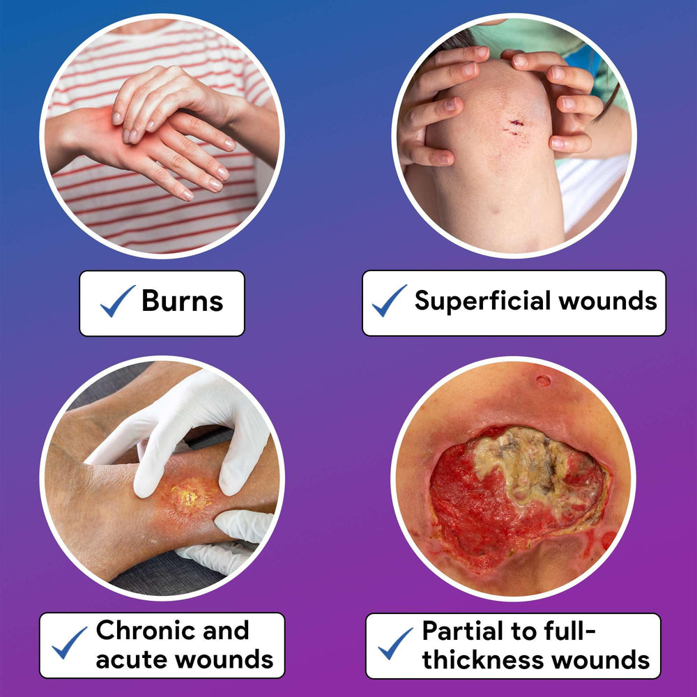 Gentell Select 9x9 dressing in clinical setting shows conformable padding for irregular wounds