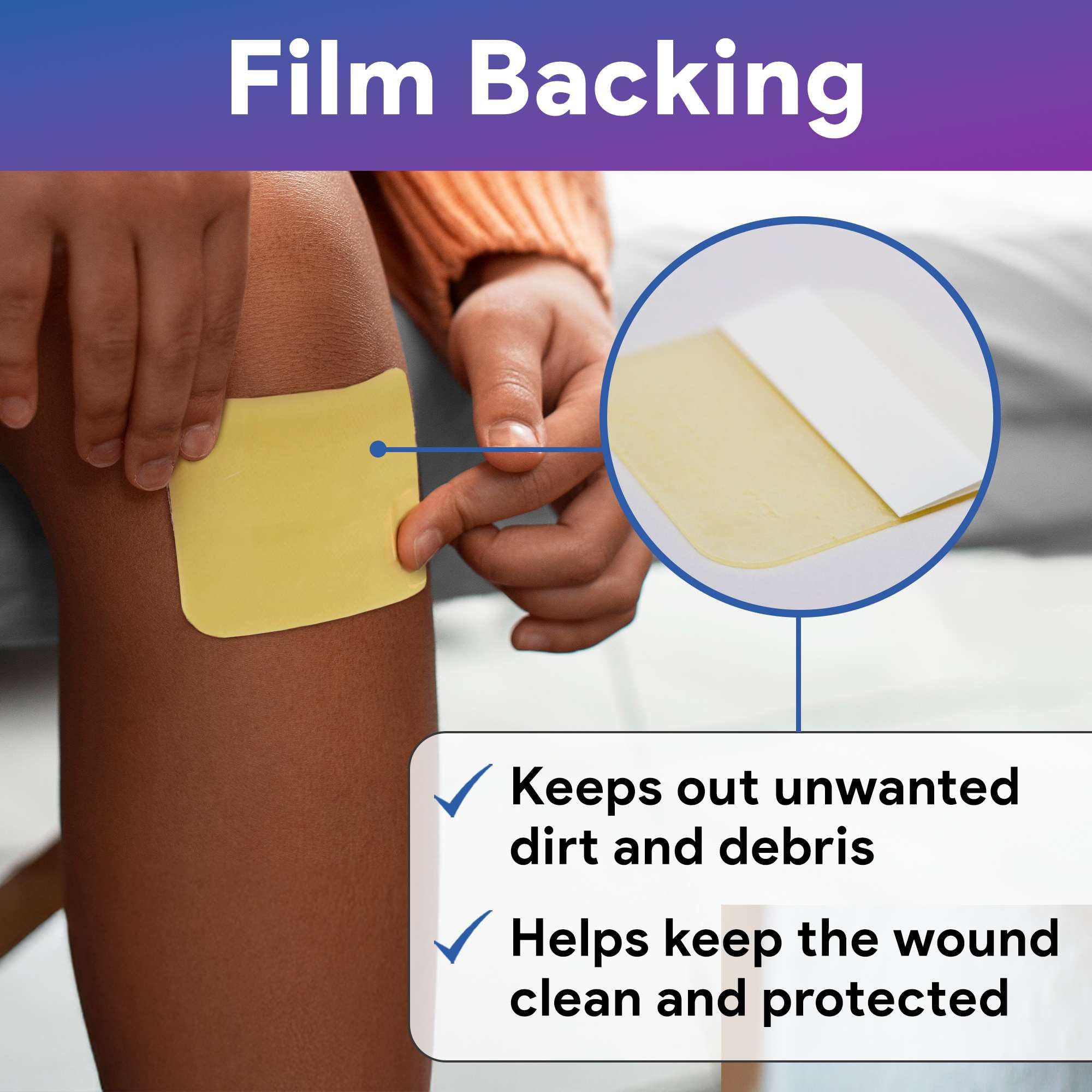 Gentell Select latex-free dressings are gentle on sensitive skin.