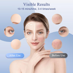 GIHWRRI soft silicone mask hugs contours gently.