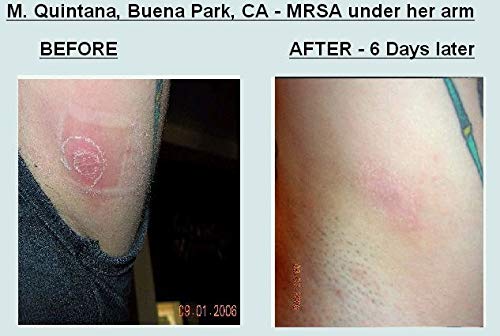 Grandma's Pine Tar Salve shown for splinters and minor burns.