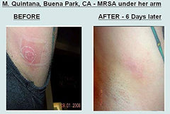 Grandma's Pine Tar Salve shown for splinters and minor burns.