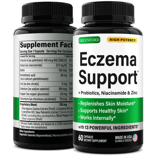 Greenford Eczema Support bottle with capsules for natural skin relief