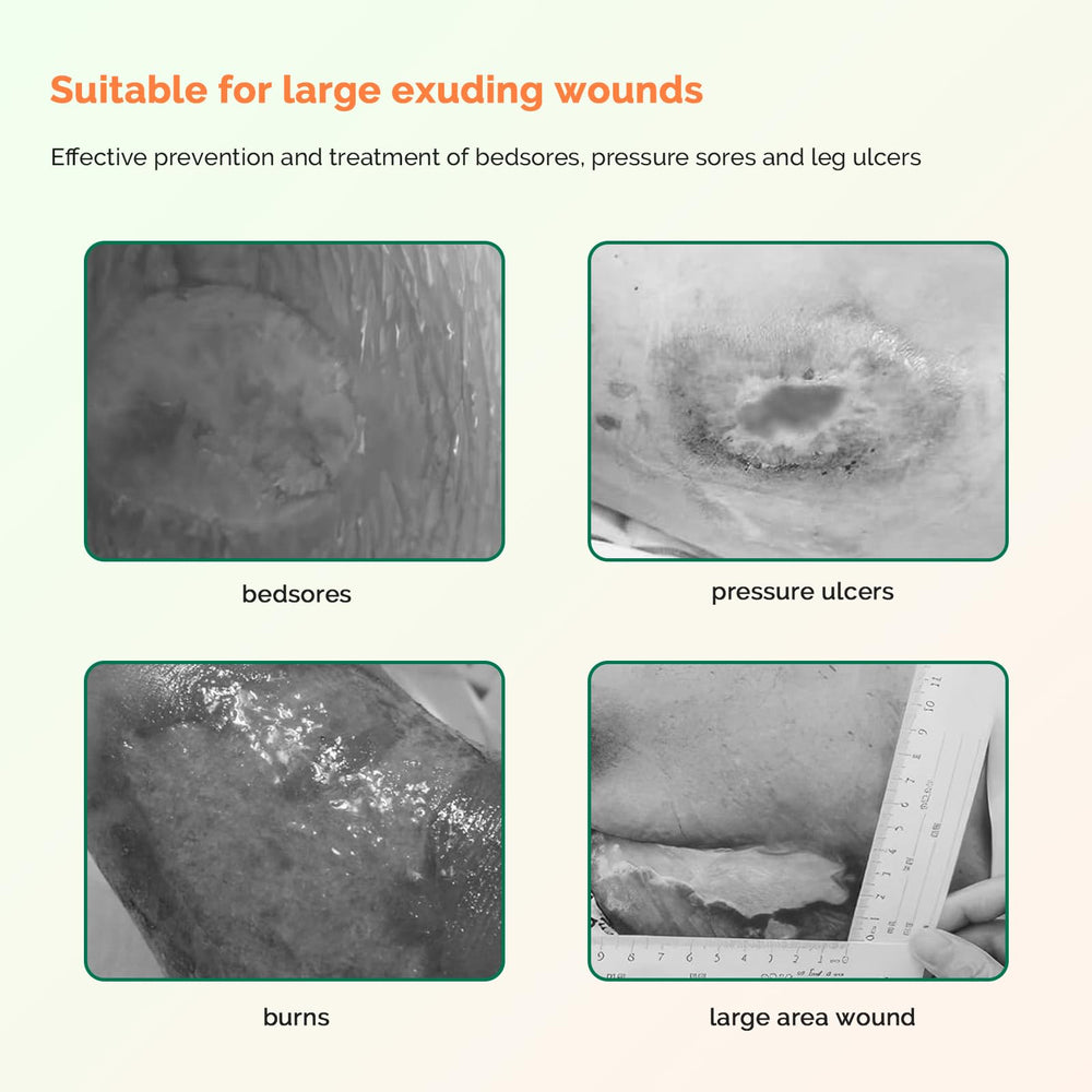 Greetmed ready-to-use Sacrum Foam Dressing in sterile packaging for convenient care.