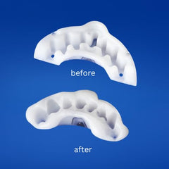 GrindRelief PRO central power bar redirects bite pressure for gentler jaw comfort.