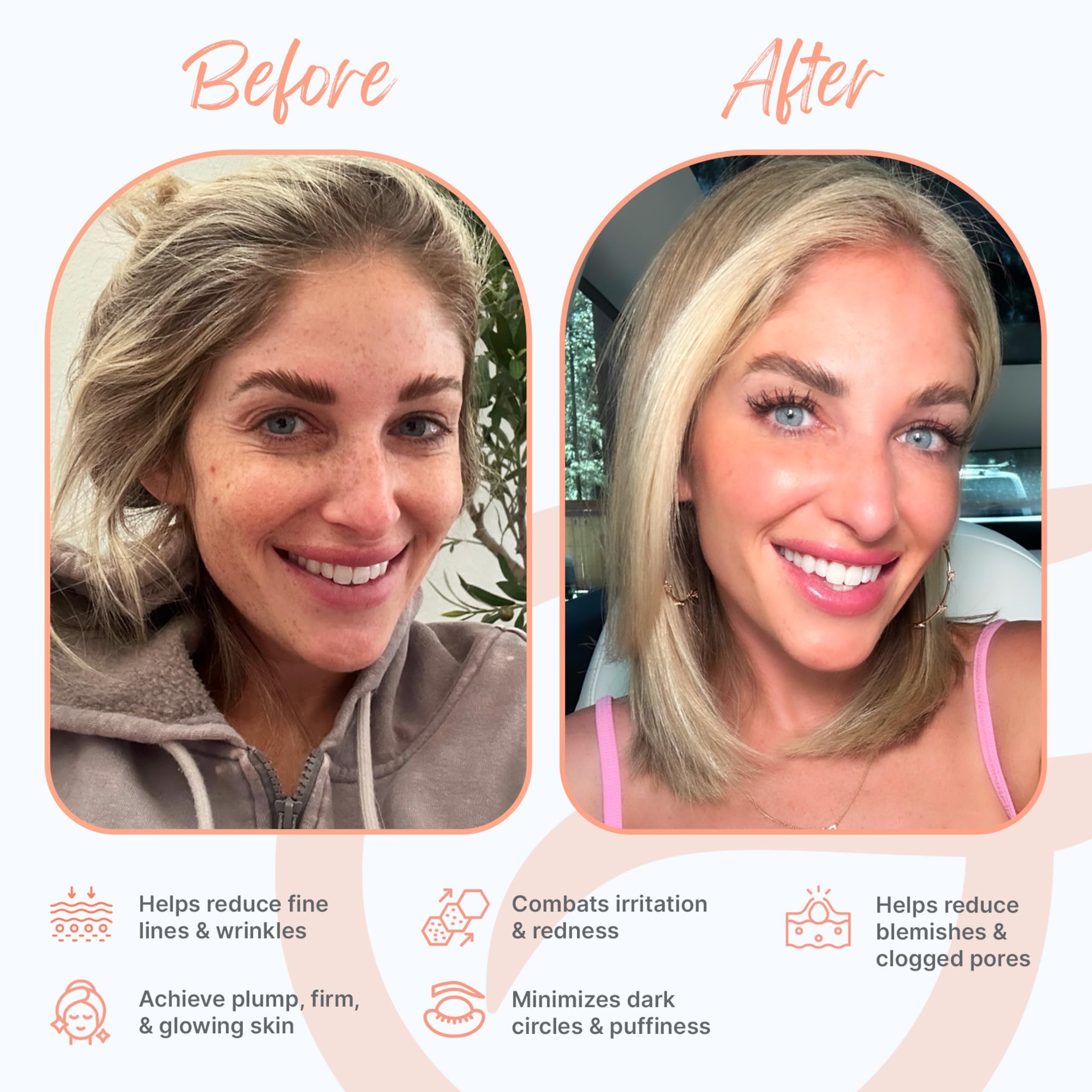 Groomie GlowUp LED mask in infrared mode for deeper vitality and glow