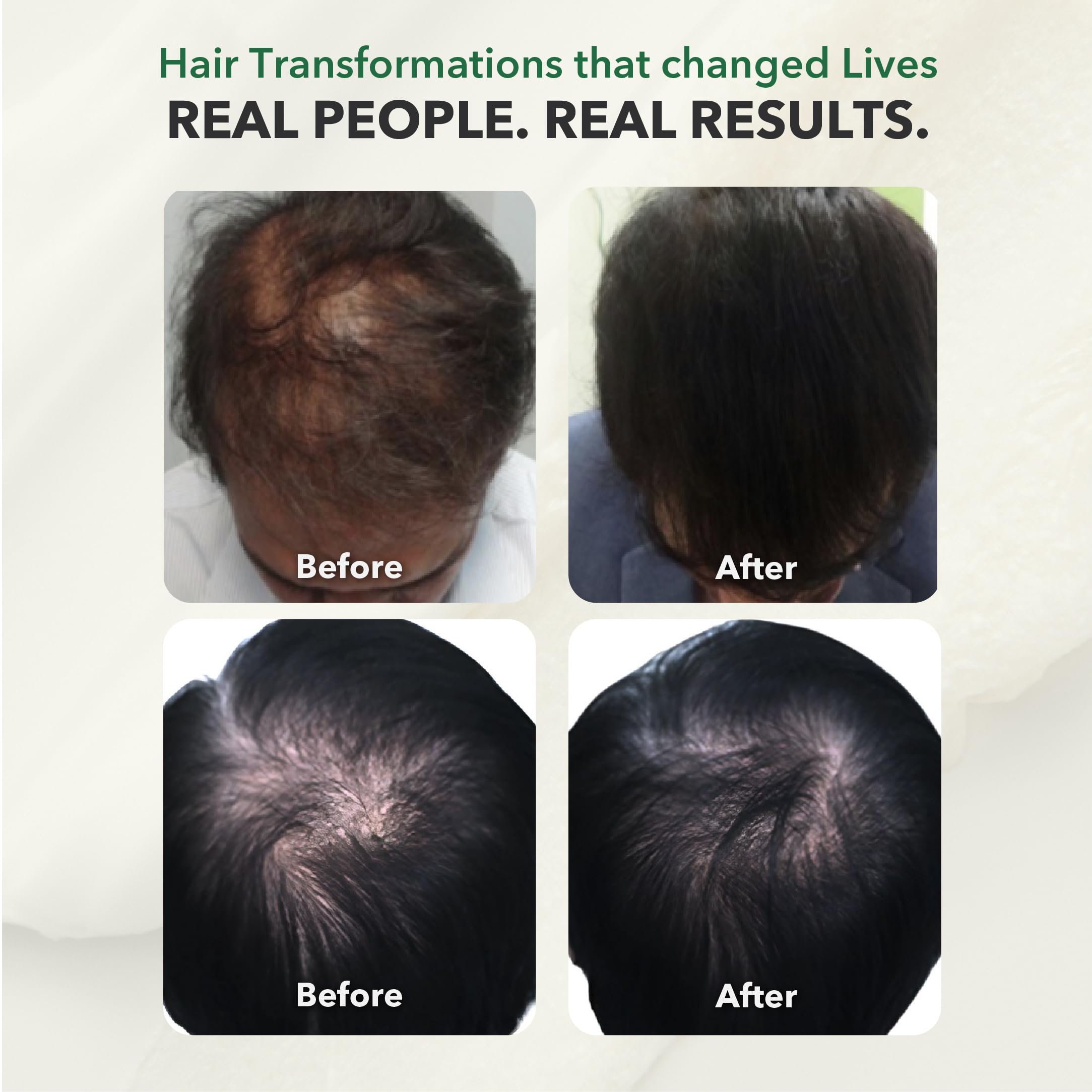 HairSmart vegan-friendly, allergen-free formula displayed on supplement facts label.