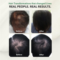 HairSmart vegan-friendly, allergen-free formula displayed on supplement facts label.