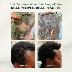 HairSmart Vegan Gluten-Free Formula bottle with allergen-free icon.