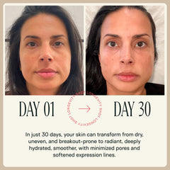 Happy Aging NAD+ shot supports a simple twice-weekly routine