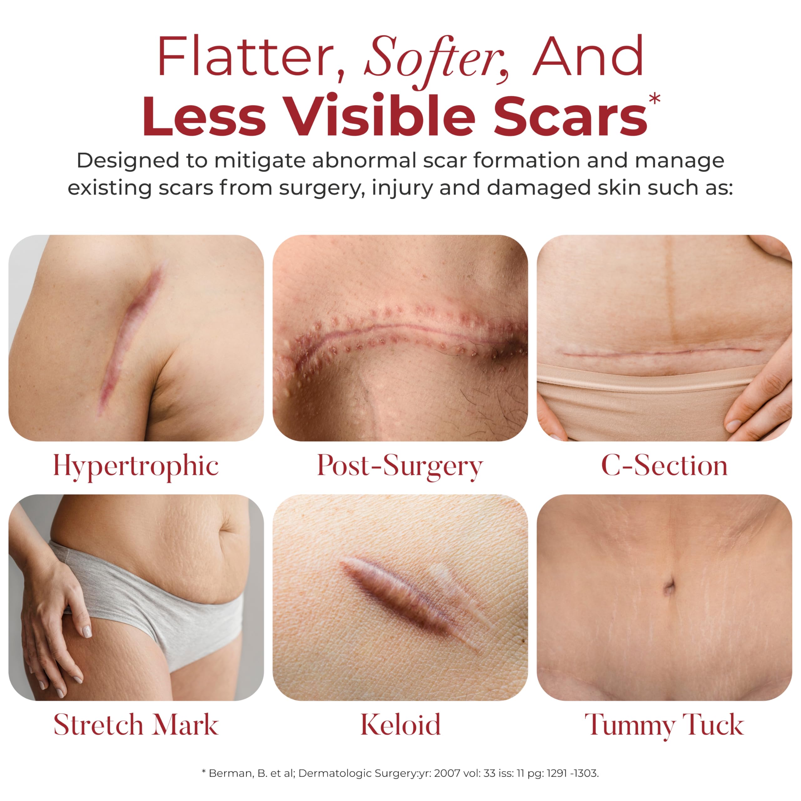 HealFast silicone scar sheets applied to abdomen after C-section for scar management