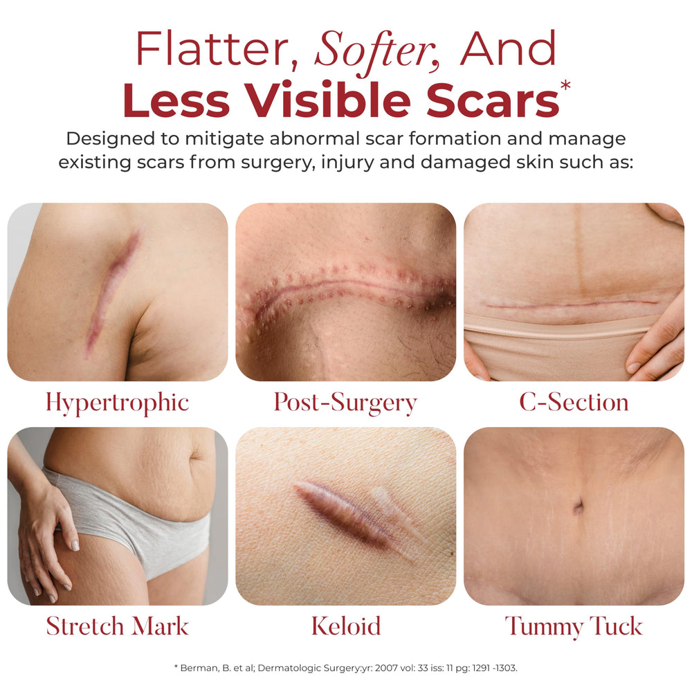 HealFast silicone scar sheets applied to abdomen after C-section for scar management