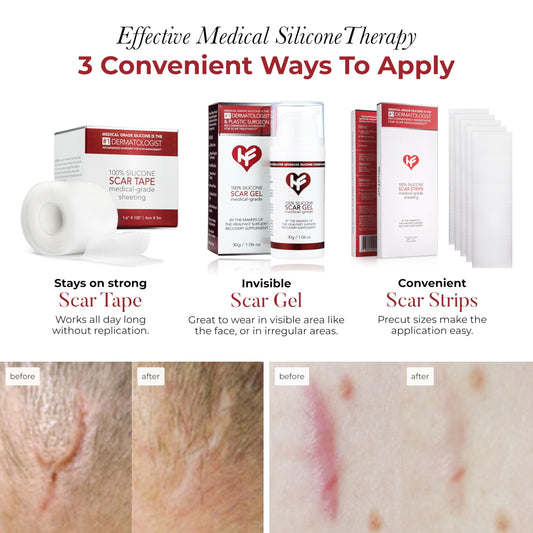 HealFast silicone scar sheets on skin application for discreet, flexible coverage