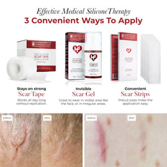 HealFast silicone scar sheets on skin application for discreet, flexible coverage