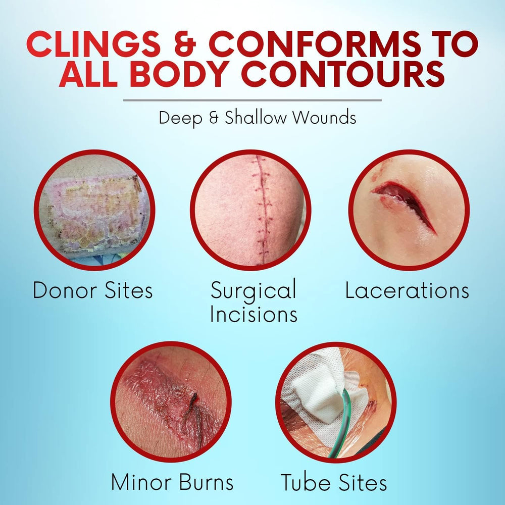 Healqu Xeroform breathable moisture environment supports comfortable healing.