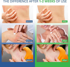 Hermon antifungal collection packaging highlighting the complete 3-in-1 daily care option