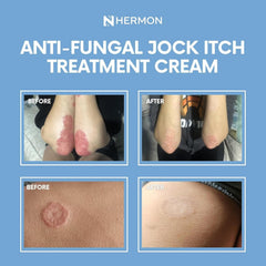 Hermon Jock Itch Cream paraben-free badge and everyday readiness