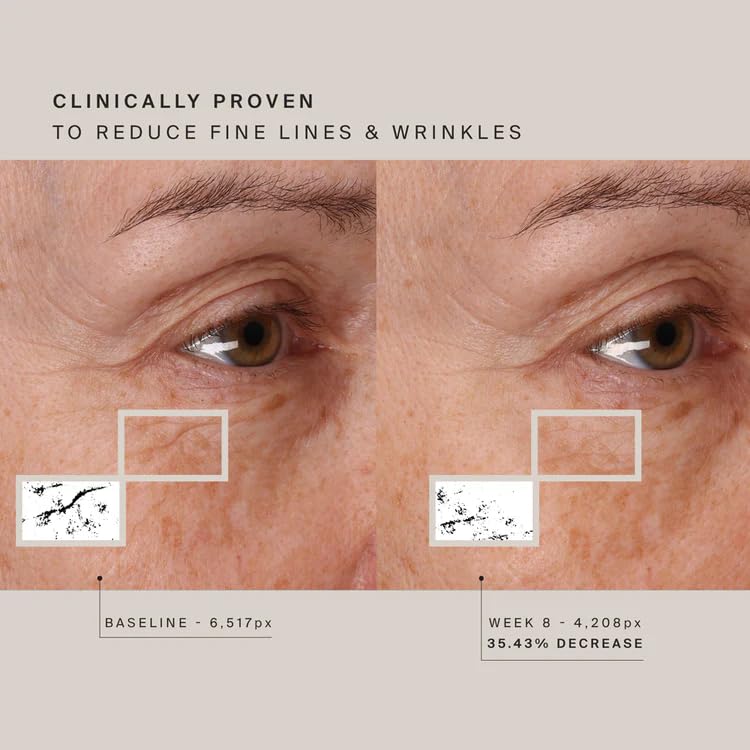 HigherDOSE wireless face mask design highlighting portable, cord-free wear.