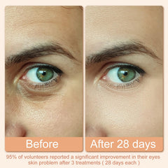 Hoakya eye massage at home soothes tired eyes during long screen sessions.