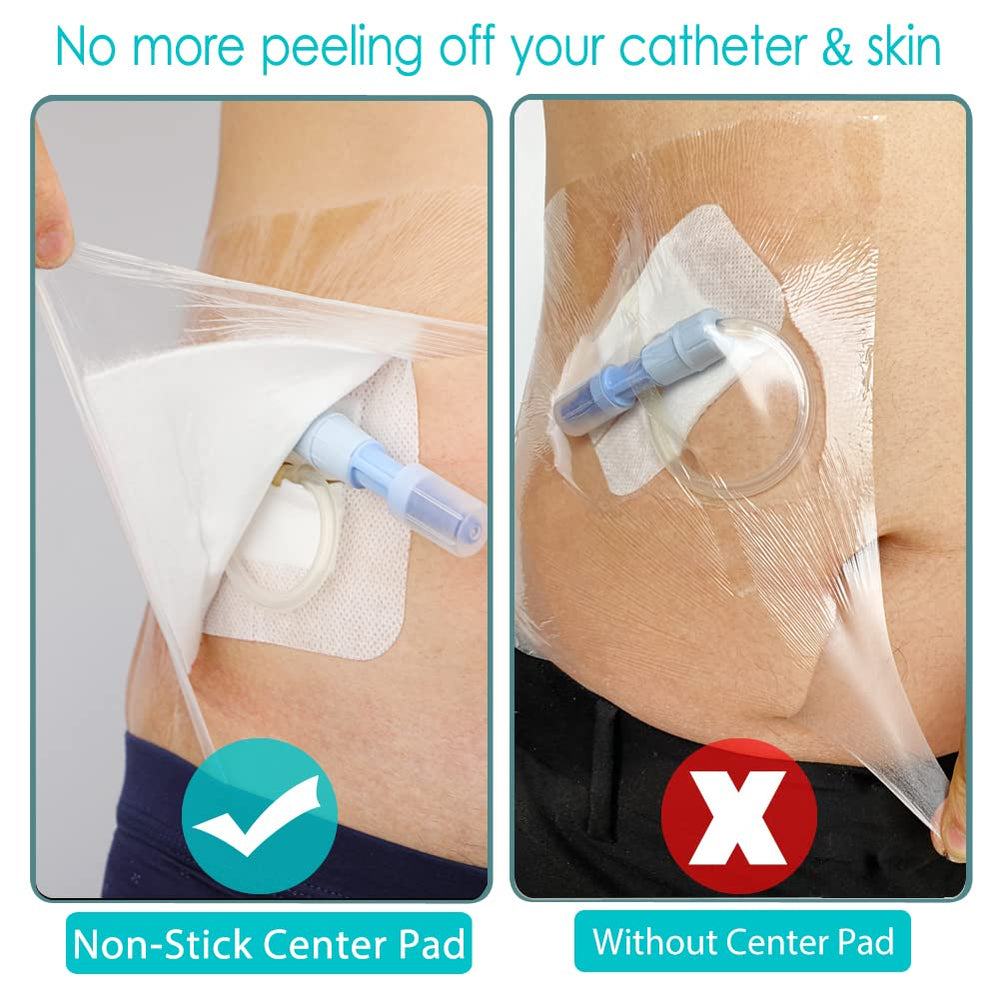 Hola Health chest catheter cover keeps the incision dry and clean.